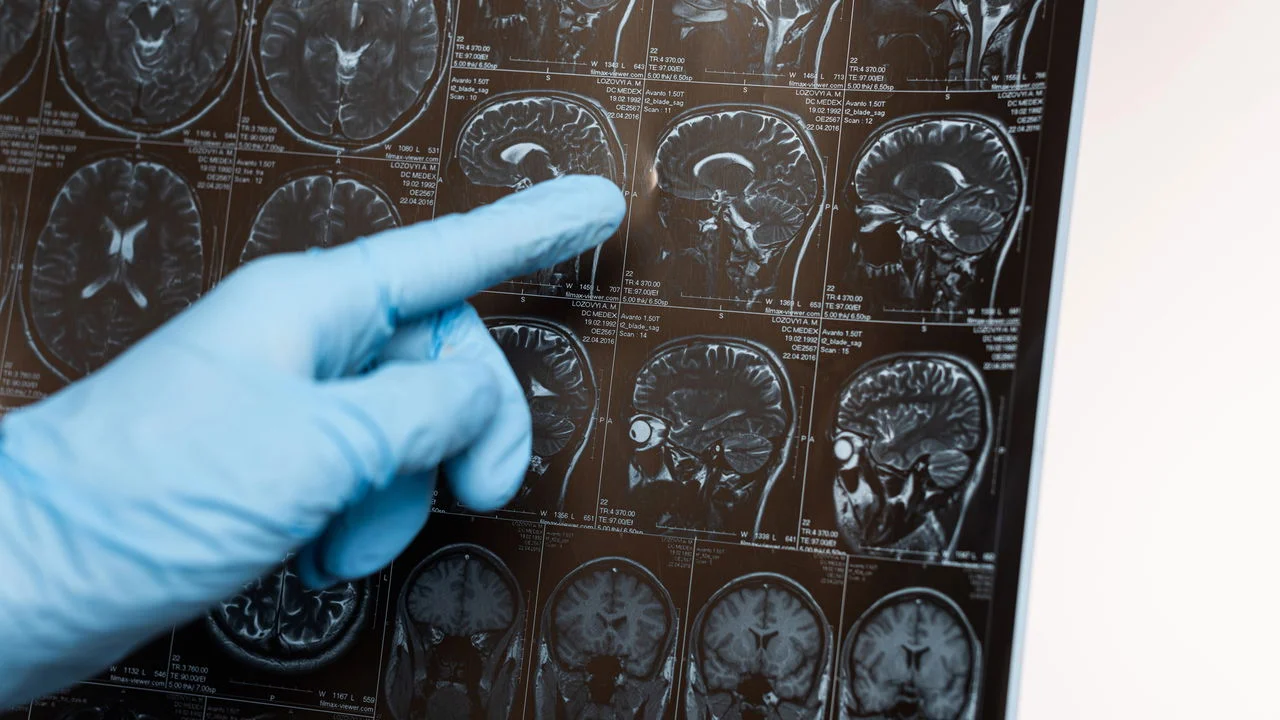 O que a creatina faz no seu cérebro? A ciência revela efeitos surpreendentes além dos músculos